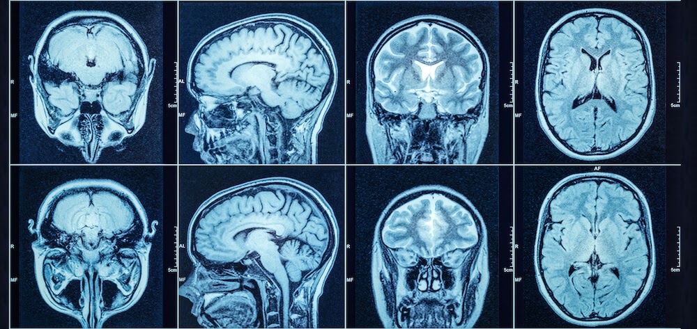 Photos from an MRI test