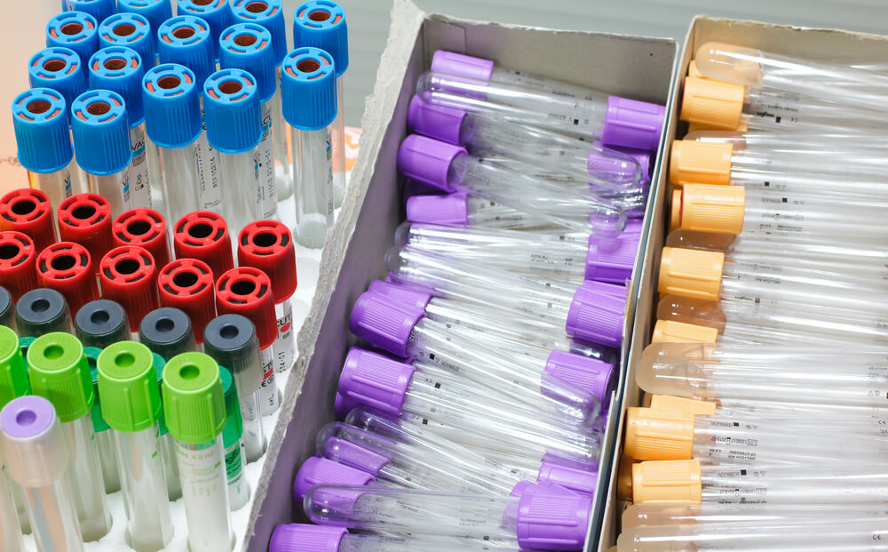 several empty tubes for collecting blood samples in the lab